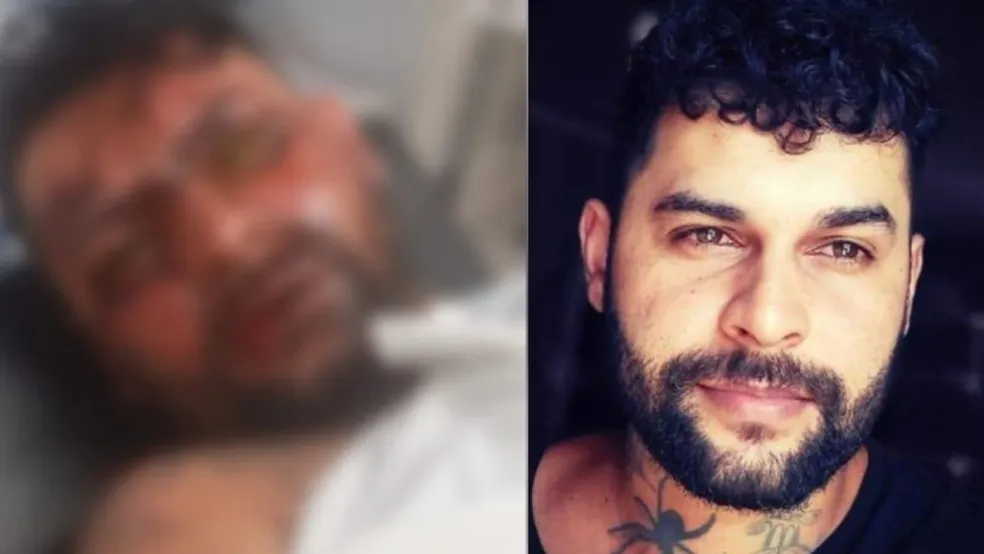 Justiça condena mulher que cegou ex-namorado com soda cáustica em Campo Grande