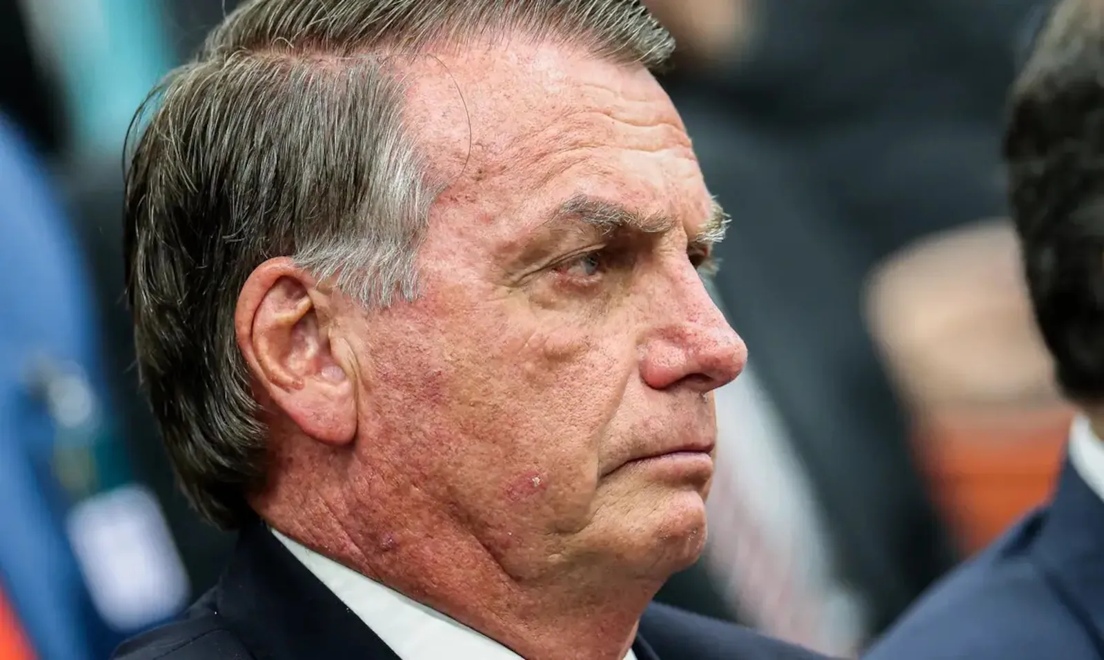 Bolsonaro sobre recomendação de repouso absoluto: ‘Crise de soluços e vômitos constantes’